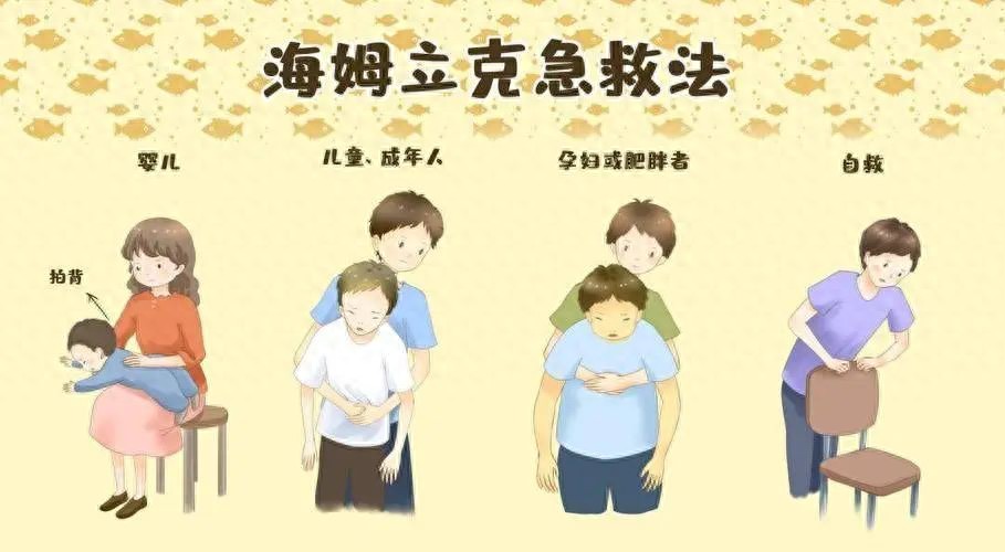 关键时刻能救命！清除气道异物，记住这个手法→