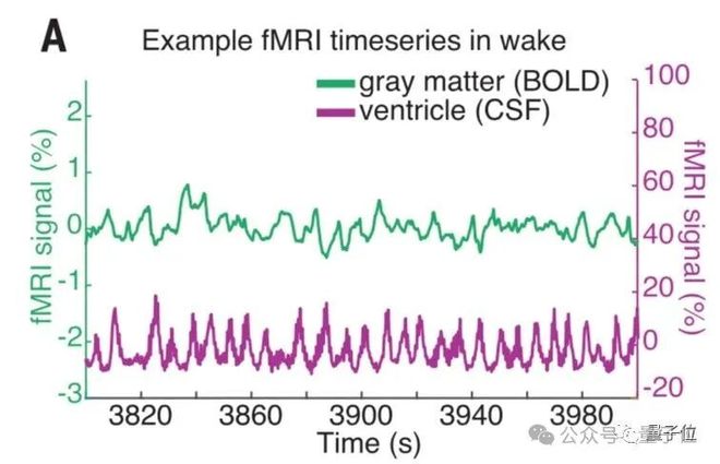 熬夜后走神不是你的错,而是自救机制在“洗脑” | Nature