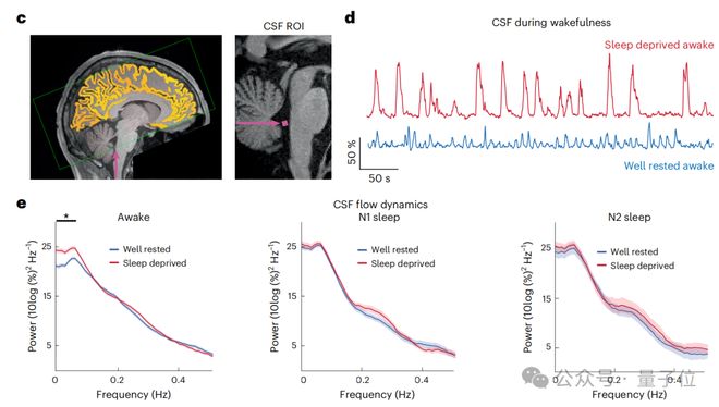 熬夜后走神不是你的错,而是自救机制在“洗脑” | Nature